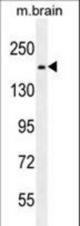 RB1CC1 Antibody western blot of mouse brain tissue lysates (35 ug/lane). The RB1CC1 antibody detected the RB1CC1 protein (arrow).