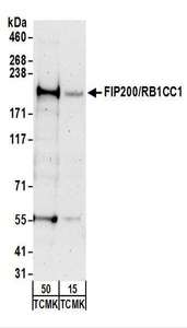 Detection of Mouse FIP200/RB1CC1 by Western Blot. Samples: Whole cell lysate from TCMK-1 (15 and 50 ug) cells. Antibodies: Affinity purified rabbit anti-FIP200/RB1CC1 antibody used for WB at 0.2 ug/ml. Detection: Chemiluminescence with an exposure time of 3 minutes.