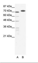 A: Marker, B: HepG2 Cell Lysate