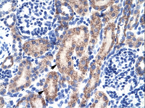 RBAK antibody LS-C29863 was used in IHC to stain formalin-fixed, paraffin-embedded human kidney.