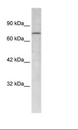 Raji Cell Lysate