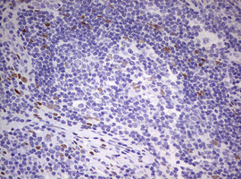 IHC of paraffin-embedded Human lymph node tissue using anti-PRRX1 mouse monoclonal antibody. (Heat-induced epitope retrieval by 10mM citric buffer, pH6.0, 120°C for 3min).
