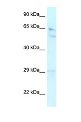 RBBP5 antibody LS-C109877 Western blot of HepG2 Cell lysate. Antibody concentration 1 ug/ml.