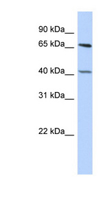 RBBP5 antibody LS-C101484 Western blot of HepG2 cell lysate.