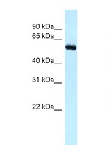 RBBP5 antibody LS-C145859 Western blot of Mouse Kidney lysate. Antibody concentration 1 ug/ml.
