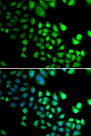 Immunofluorescence blot of U20S cell using RBBP5 antibody. Blue: DAPI for nuclear staining.