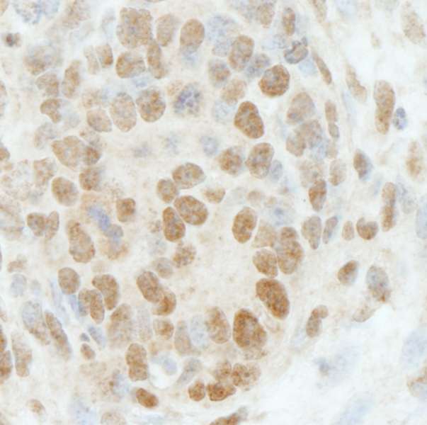 Detection of Mouse RbBP5 by Immunohistochemistry. Sample: FFPE section of mouse teratoma. Antibody: Affinity purified rabbit anti-RbBP5 used at a dilution of 1:250.