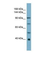 Western blot of Human ACHN Whole cell . RBBP6 antibody dilution 1.0 ug/ml.