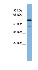 RBBP7 / RbAp46 antibody LS-C107661 Western blot of Fetal Thymus lysate.