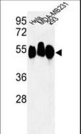 Western blot of RBBP7 Antibody in HeLa, MDA-MB231, 293 cell line lysates (35 ug/lane). RBBP7 (arrow) was detected using the purified antibody.