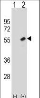 Western blot of RBBP7 (arrow) using rabbit polyclonal RBBP7 Antibody. 293 cell lysates (2 ug/lane) either nontransfected (Lane 1) or transiently transfected (Lane 2) with the RBBP7 gene.