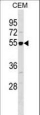 RBBP7 Antibody western blot of CEM cell line lysates (35 ug/lane). The RBBP7 antibody detected the RBBP7 protein (arrow).