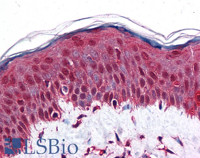 Anti-RBBP8 / CTIP antibody IHC of human skin. Immunohistochemistry of formalin-fixed, paraffin-embedded tissue after heat-induced antigen retrieval. Antibody LS-B4843 concentration 10 ug/ml.