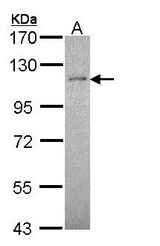 Sample (30 ug of whole cell lysate). A: Hep G2. 7.5% SDS PAGE. RBBP8 antibody diluted at 1:5000.