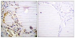 IHC of paraffin-embedded human thyroid gland tissue, using RBBP8 Antibody. The sample on the right was incubated with synthetic peptide.