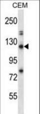 RBBP8 Antibody western blot of CEM cell line lysates (35 ug/lane). The RBBP8 antibody detected the RBBP8 protein (arrow).