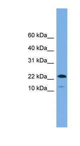 WFDC1 antibody LS-C110917 Western blot of Placenta lysate.