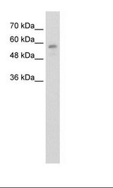 Jurkat Cell Lysate