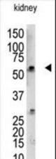 The anti-UBCE7IP3 antibody is used in Western blot to detect UBCE7IP3 in mouse kidney tissue lysate.