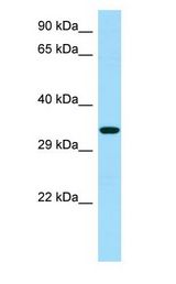 RBFA antibody Western Blot of HeLa.