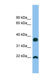 WFDC1 antibody LS-C116685 Western blot of A549 cell lysate.
