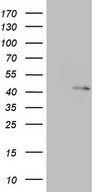 HEK293T cells were transfected with the pCMV6-ENTRY control (Left lane) or pCMV6-ENTRY RBFOX1 (Right lane) cDNA for 48 hrs and lysed. Equivalent amounts of cell lysates (5 ug per lane) were separated by SDS-PAGE and immunoblotted with anti-RBFOX1.