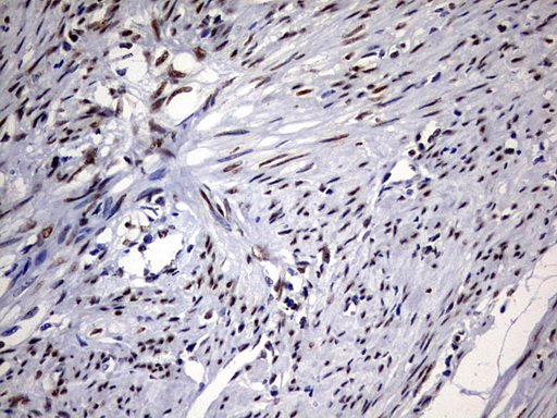 IHC of paraffin-embedded Human endometrium tissue using anti-RBFOX1 mouse monoclonal antibody. (Heat-induced epitope retrieval by 1 mM EDTA in 10mM Tris, pH8.5, 120°C for 3min).