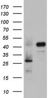 HEK293T cells were transfected with the pCMV6-ENTRY control (Left lane) or pCMV6-ENTRY RBFOX1 (Right lane) cDNA for 48 hrs and lysed. Equivalent amounts of cell lysates (5 ug per lane) were separated by SDS-PAGE and immunoblotted with anti-RBFOX1.