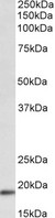 WFDC1 antibody (0.3 ug/ml) staining of Mouse Heart lysate (35 ug protein in RIPA buffer). Primary incubation was 1 hour. Detected by chemiluminescence.