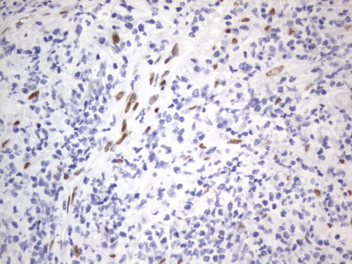 IHC of paraffin-embedded Human lymph node tissue using anti-RBFOX1 mouse monoclonal antibody. (Heat-induced epitope retrieval by 1 mM EDTA in 10mM Tris, pH8.5, 120°C for 3min).