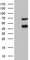 HEK293T cells were transfected with the pCMV6-ENTRY control (Left lane) or pCMV6-ENTRY RBFOX1 (Right lane) cDNA for 48 hrs and lysed. Equivalent amounts of cell lysates (5 ug per lane) were separated by SDS-PAGE and immunoblotted with anti-RBFOX1.