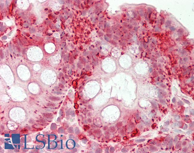 Human Colon: Formalin-Fixed, Paraffin-Embedded (FFPE)