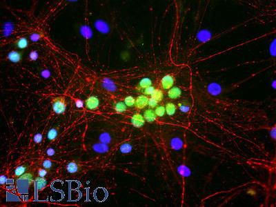 Rat brain neural cultures stained with RBFOX1 / A2BP1 antibody (green), rabbit polyclonal antibody to NF-M (red) and DNA (blue). The RBFOX1 / A2BP1 antibody antibody reveals nuclear and distal cytoplasmic staining for Fox1, and the complete absence of staining of non-neuronal cells.