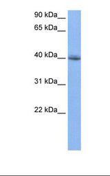 Jurkat cell lysate. Antibody concentration: 0.5 ug/ml. Gel concentration: 12%.