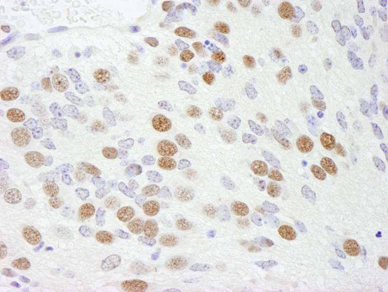 Detection of Mouse RBM9 by Immunohistochemistry. Sample: FFPE section of mouse teratoma. Antibody: Affinity purified rabbit anti-RBM9 used at a dilution of 1:250.