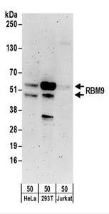 Detection of Human RBM9 by Western Blot. Samples: Whole cell lysate (50 ug) from HeLa, 293T, and Jurkat cells. Antibodies: Affinity purified rabbit anti-RBM9 antibody used for WB at 0.1 ug/ml. Detection: Chemiluminescence with an exposure time of 3 minutes.