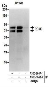 Detection of Human RBM9 by Western Blot of Immunoprecipitates. Samples: Whole cell lysate (1 mg for IP; 20% of IP loaded) from HeLa cells. Antibodies: Affinity purified rabbit anti-RBM9 antibody used for IP at 6 ug/mg lysate. RBM9 was also immunoprecipitated by a previous lot of this antibody. For blotting immunoprecipitated RBM9, -2 was used at 1 ug/ml. Detection: Chemiluminescence with an exposure time of 30 seconds.
