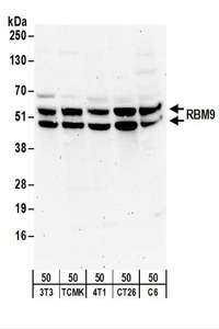 Detection of Mouse and Rat RBM9 by Western Blot. Samples: Whole cell lysate (50 ug) from NIH3T3, TCMK-1, 4T1, CT26.WT, and rat C6 cells. Antibodies: Affinity purified rabbit anti-RBM9 antibody used for WB at 0.5 ug/ml. Detection: Chemiluminescence with an exposure time of 3 minutes.