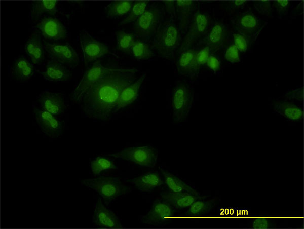 Immunofluorescence of monoclonal antibody to RBM9 on HeLa cell. [antibody concentration 10 ug/ml]