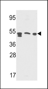 Western blot of SAP Antibody (Center E300) in Y79,A2058,CEM cell line lysates(35 ug/lane). SAP (arrow) was detected using the purified antibody.
