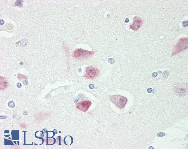 Anti-RBFOX3 / NEUN antibody IHC staining of human brain, cortex. Immunohistochemistry of formalin-fixed, paraffin-embedded tissue after heat-induced antigen retrieval. Antibody LS-B10249 concentration 10 ug/ml.