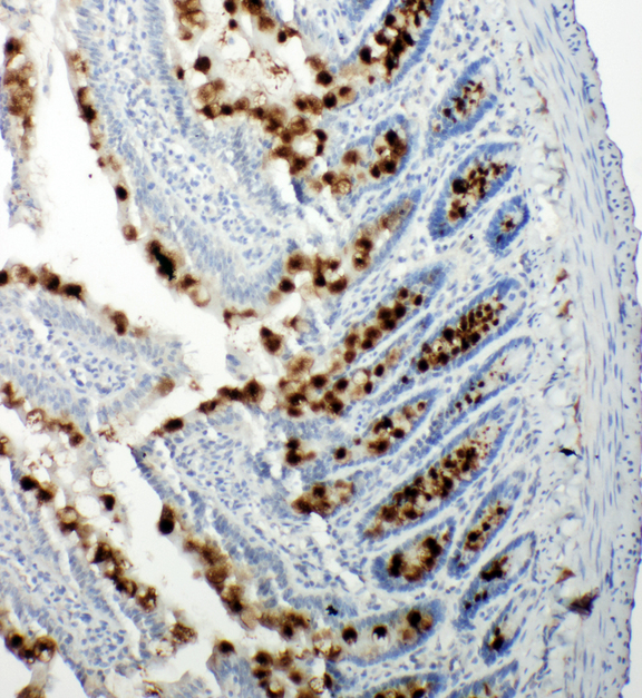 RBL1 / p107 antibody. IHC(P): Rat Intestine Tissue.
