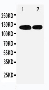 WB of RBL1 / p107 antibody. All lanes: Anti-RBL1 at 0.5ug/ml. Lane 1: 239T Whole Cell Lysate at 40ug. Lane 2: JURKAT Whole Cell Lysate at 40ug. Predicted bind size: 121KD. Observed bind size: 121KD.