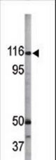 The anti-Phospho-Rb-like-1-S975 antibody is used in Western blot to detect Phospho-Rb-like-1-S975 in A2058 tissue lysate