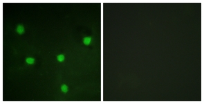 Immunofluorescence of NIH-3T3 cells, using RBL1 (Ab-369) Antibody. The picture on the right is treated with the synthesized peptide.