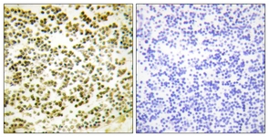 IHC of paraffin-embedded human lymph node, using RBL1 (Phospho-Thr369) Antibody. The sample on the right was incubated with synthetic peptide.