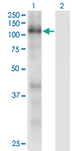 Western Blot analysis of RBL1 expression in transfected 293T cell line by RBL1 monoclonal antibody (M01), clone 1A5.Lane 1: RBL1 transfected lysate (Predicted MW: 111.54 KDa).Lane 2: Non-transfected lysate.