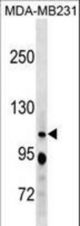 RBL1 Antibody western blot of MDA-MB231 cell line lysates (35 ug/lane). The RBL1 antibody detected the RBL1 protein (arrow).