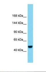 Western blot of Human Liver Tumor. RBL2 antibody dilution 1.0 ug/ml.