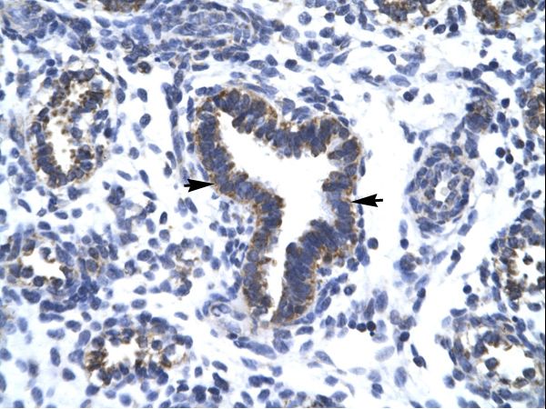 RBM10 antibody LS-C31457 was used in IHC to stain formalin-fixed, paraffin-embedded human lung.
